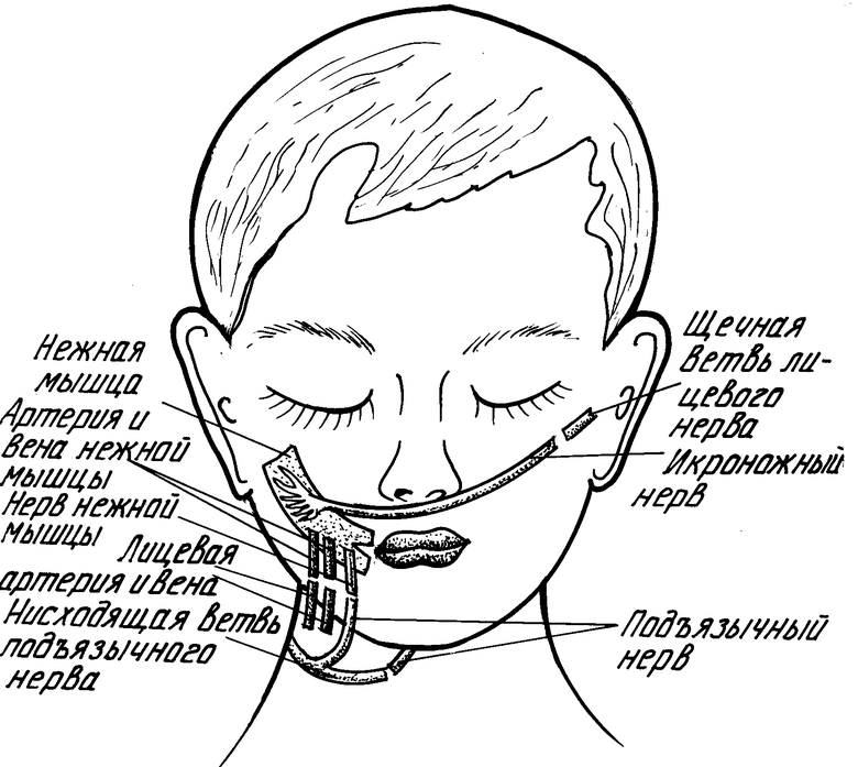 Неврит лицевого нерва схема. Тейпирование лица при неврите лицевого нерва. Массаж лица при парезе лицевого нерва. Неврите лицевого нерва электростимуляция.
