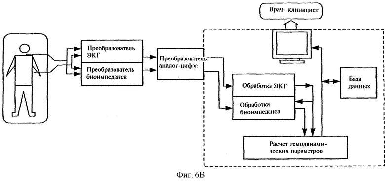 Структурная схема экг