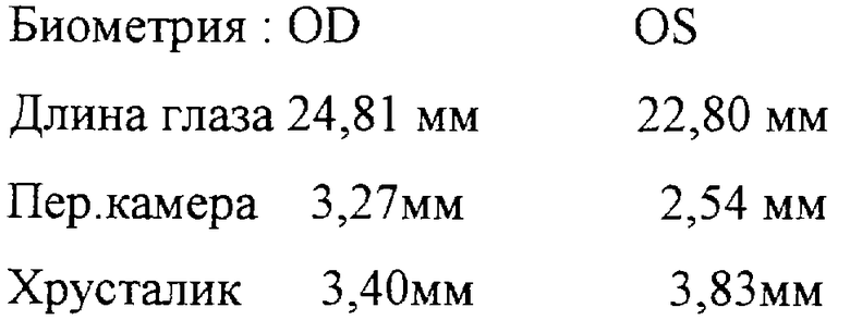 Биометрия пзо. Биометрия глаза расшифровка показателей. Ультразвуковая биометрия глаза норма. Оптическая биометрия глаза норма. Биометрия ПЗО глаза.