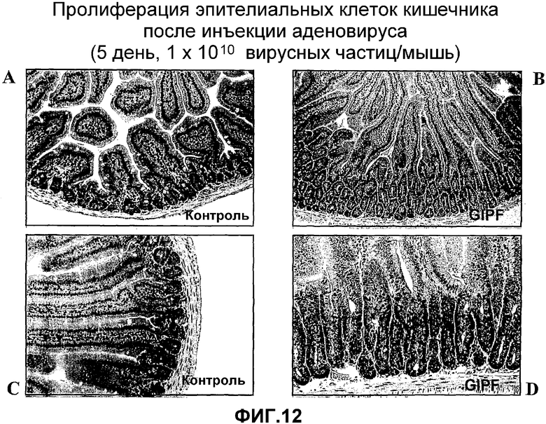 Полип пролиферативного типа. Пролиферативная активность базальных клеток.. Деструктивно-пролиферативный тромбоэндоваскулит это. Ограниченный пролиферативный потенциал.