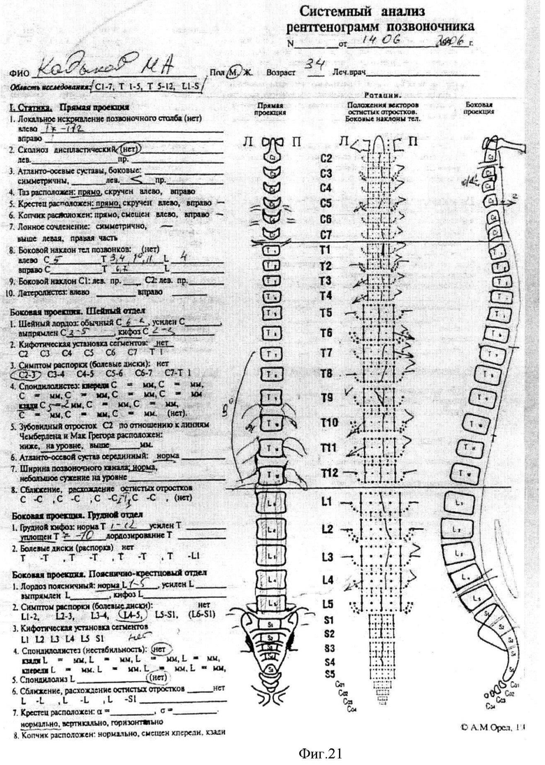 Индекс орла