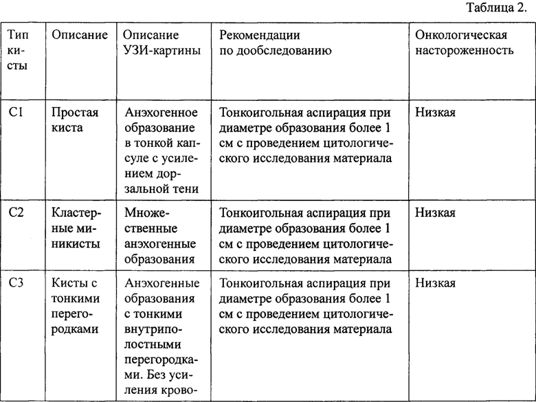 Киста молочной железы