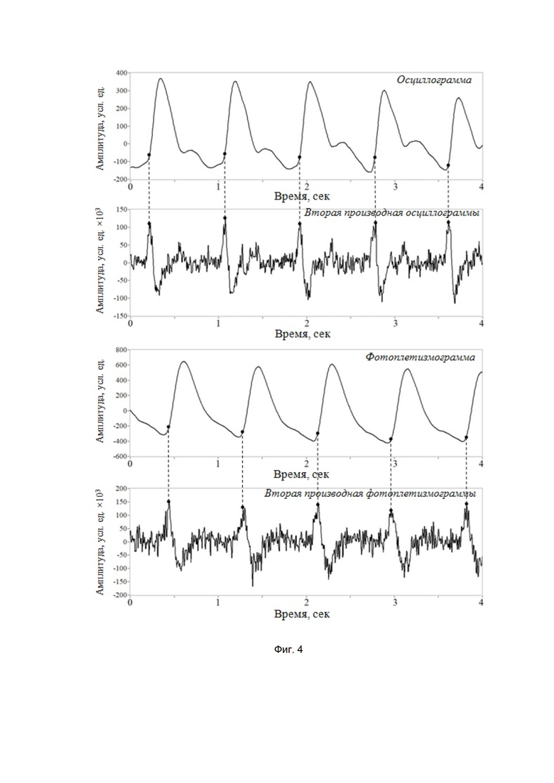 Курсовая работа по теме Устройство для измерения скорости распространения пульсовой волны кровотока