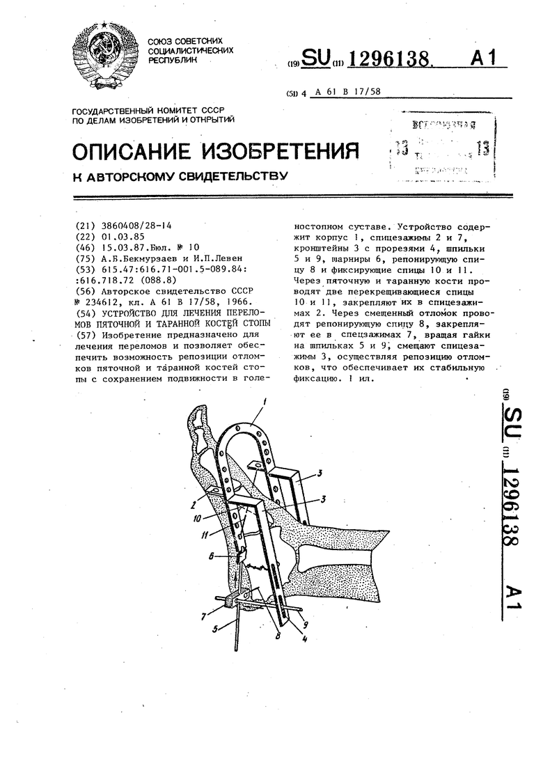 Как установить витафон при пяточной шпоре фото