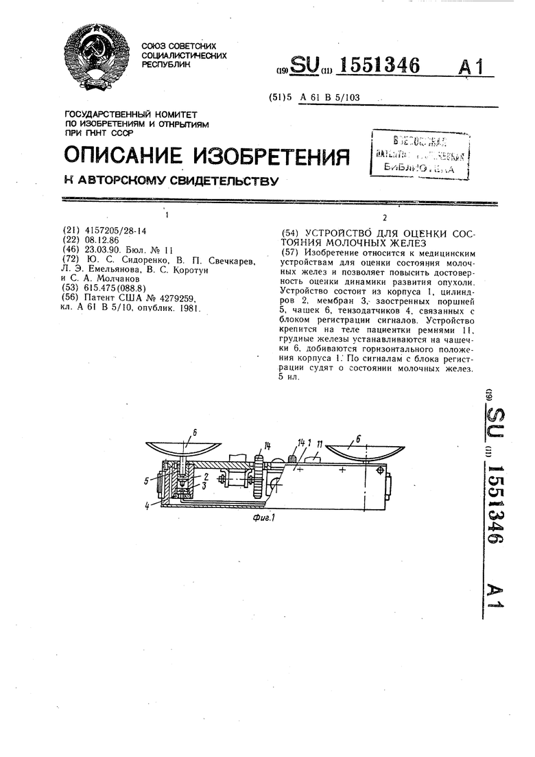 Реферат: Грудные железы