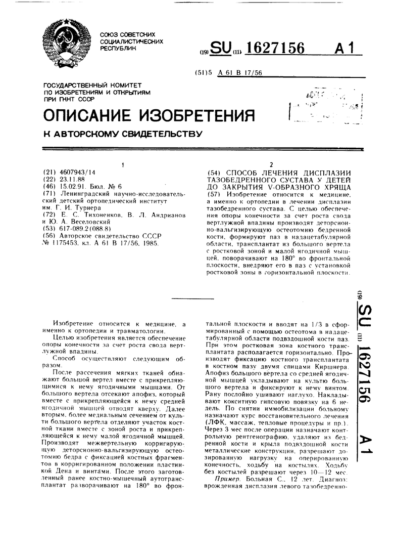 Реферат: Дисплазия тазобедренного сустава