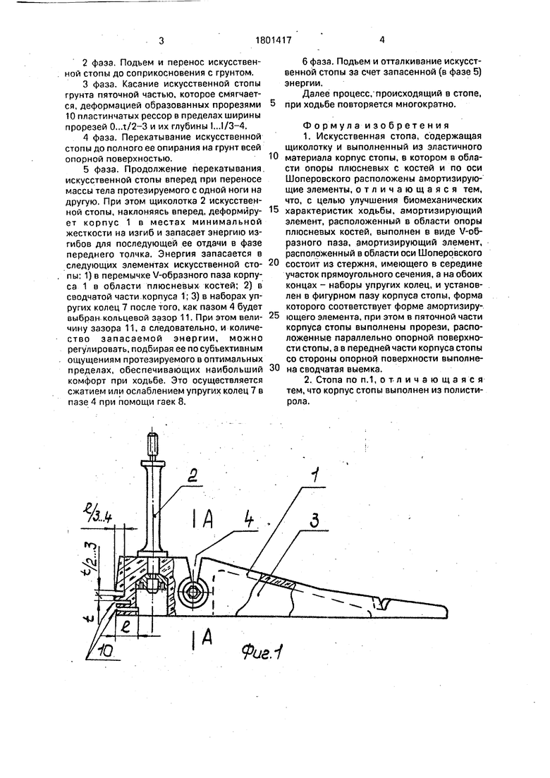 Искусственная стопа. Советский патент 1993 года SU 1801417 A1. Изобретение  по МКП A61F2/66 .